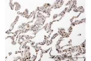 Immunoperoxidase of monoclonal antibody to HMG2L1 on formalin-fixed paraffin-embedded human lung. (HMGXB4 antibody  (AA 1-74))