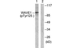 Western blot analysis of extracts from NIH-3T3 cells treated with Insulin 0. (WASF1 antibody  (pTyr125))