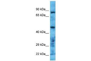 Host: Rabbit Target Name: TMPRSS11B Sample Type: Hela Whole Cell lysates Antibody Dilution: 1. (TMPRSS11B antibody  (N-Term))