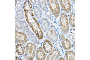 Immunohistochemistry of paraffin-embedded mouse kidney using GRPEL2 Rabbit pAb (ABIN6132810, ABIN6141437, ABIN6141438 and ABIN6224364) at dilution of 1:200 (40x lens). (GRPEL2 antibody  (AA 33-225))