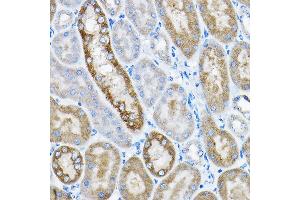Immunohistochemistry of paraffin-embedded mouse kidney using GRPEL2 Rabbit pAb (ABIN6132810, ABIN6141437, ABIN6141438 and ABIN6224364) at dilution of 1:200 (40x lens).