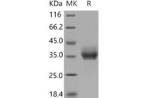 Western Blotting (WB) image for Epithelial Cell Adhesion Molecule (EPCAM) (Active) protein (His tag) (ABIN7195602) (EpCAM Protein (His tag))