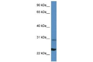 WB Suggested Anti-Rpl17 Antibody Titration: 1. (RPL17 antibody  (N-Term))