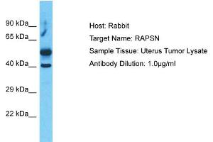 Host:  Rabbit  Target Name:  RAPSN  Sample Type:  Uterus Tumor lysates  Antibody Dilution:  1.