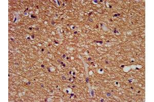 IHC image of ABIN7145619 diluted at 1:500 and staining in paraffin-embedded human brain tissue performed on a Leica BondTM system. (FHIT antibody  (AA 2-147))