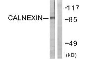 Western blot analysis of extracts from HeLa cells, treated with EGF 200ng/ml 30', using Calnexin (Ab-583) Antibody. (Calnexin antibody  (AA 543-592))