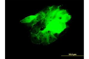 Immunofluorescence (IF) image for anti-CDC42 Binding Protein Kinase beta (DMPK-Like) (CDC42BPB) (AA 1580-1679) antibody (ABIN523071)