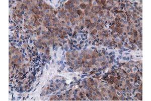 Immunohistochemical staining of paraffin-embedded Human pancreas tissue using anti-VWA5A mouse monoclonal antibody. (VWA5A antibody)