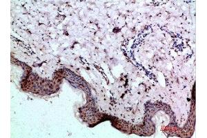 Immunohistochemical analysis of paraffin-embedded human-skin, antibody was diluted at 1:200