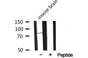 Western blot analysis of extracts from mouse Brian, using MARK2 antibody. (MARK2 antibody  (Internal Region))