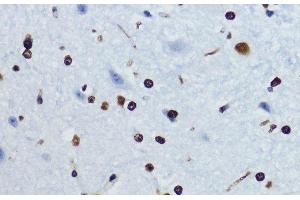 Immunohistochemistry of paraffin-embedded Mouse spinal cord using Acetyl-Histone H4-K12 Polyclonal Antibody at dilution of 1:200 (40x lens). (Histone H4 antibody  (acLys12))