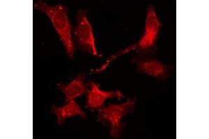 ABIN6278549 staining Hela by IF/ICC. (Adenosine A2b Receptor antibody  (Internal Region))