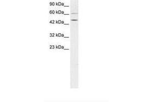 Image no. 1 for anti-T-Box 19 (TBX19) (AA 207-256) antibody (ABIN6736274) (T-Box 19 antibody  (AA 207-256))