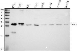 Western blot analysis of MED8 using anti-MED8 antibody (ABIN5519031).