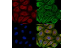 ABIN6257415 and ABIN6275226 staining Hela cells by IF/ICC.