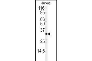 Western blot analysis of anti-JUND Antibody (S255) in Jurkat cell line lysates (35ug/lane) (JunD antibody  (AA 233-262))