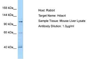 Western Blotting (WB) image for anti-Histone Deacetylase 4 (HDAC4) (C-Term) antibody (ABIN2781487)