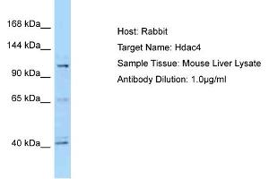 WB Suggested Anti-Hdac4 Antibody   Titration: 1. (HDAC4 antibody  (C-Term))