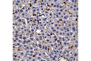 Immunohistochemistry of paraffin embedded rat liver using ANXA3 (ABIN7073065) at dilution of 1: 300 (400x lens) (Annexin A3 antibody)