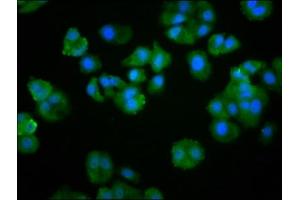 Immunofluorescence staining of HepG2 cells with ABIN7174103 at 1:266, counter-stained with DAPI. (PTPN22 antibody  (AA 1-179))