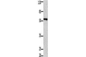 Western Blotting (WB) image for anti-GDNF Family Receptor alpha 1 (GFRA1) antibody (ABIN2431439) (GFRA1 antibody)