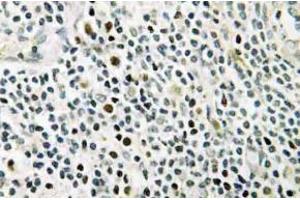 Immunohistochemistry (IHC) analyzes of NPM antibody in paraffin-embedded human tonsil tissue.