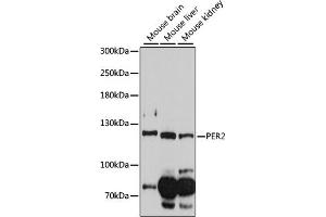 Western blot analysis of extracts of various cell lines, using PER2 antibody (ABIN6134741, ABIN6145451, ABIN6145453 and ABIN6218314) at 1:1000 dilution. (PER2 antibody  (AA 1-100))
