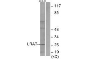 Western blot analysis of extracts from COLO205 cells, using LRAT Antibody. (LRAT antibody  (AA 111-160))