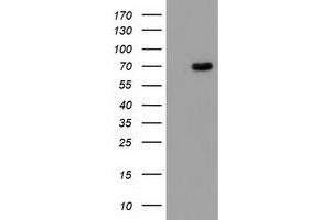 HEK293T cells were transfected with the pCMV6-ENTRY control (Left lane) or pCMV6-ENTRY BCHE (Right lane) cDNA for 48 hrs and lysed. (Butyrylcholinesterase antibody)