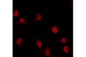 ABIN6274545 staining HuvEc by IF/ICC. (FOXD3 antibody  (Internal Region))