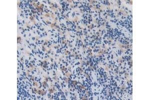Used in DAB staining on fromalin fixed paraffin- embedded Kidney tissue (Manic Fringe antibody  (AA 56-309))