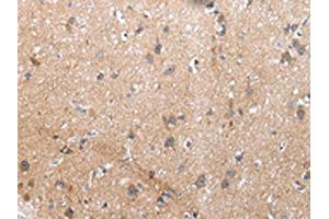 The image on the left is immunohistochemistry of paraffin-embedded Human brain tissue using ABIN7193075(XKR4 Antibody) at dilution 1/20, on the right is treated with synthetic peptide. (XKR4 antibody)
