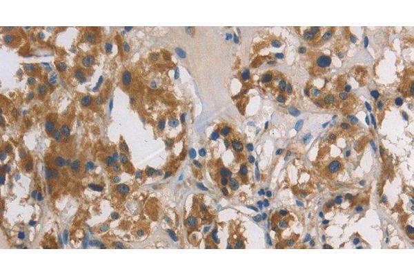 DUSP26 antibody