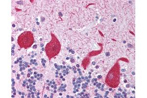 Anti-TLR10 antibody IHC of human brain, cerebellum. (TLR10 antibody)