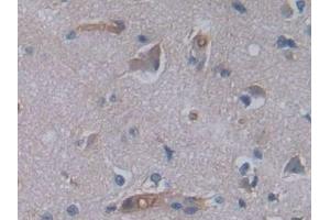 Detection of JAG2 in Human Cerebrum Tissue using Polyclonal Antibody to Jagged 2 Protein (JAG2)