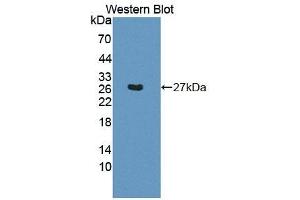 Detection of Recombinant BCAT1, Mouse using Polyclonal Antibody to Branched Chain Aminotransferase 1, Cytosolic (BCAT1) (BCAT1 antibody  (AA 158-386))