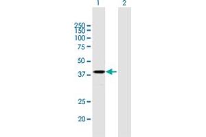 Western Blot analysis of PSG2 expression in transfected 293T cell line by PSG2 MaxPab polyclonal antibody. (PSG2 antibody  (AA 1-335))