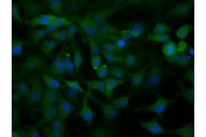 Image no. 10 for anti-Acetyl-CoA Acetyltransferase 2 (ACAT2) antibody (ABIN1496403) (ACAT2 antibody)