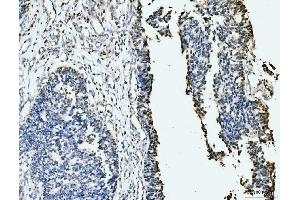 IHC analysis of MCM6 using anti-MCM6 antibody (ABIN7600038). (MCM6 antibody  (AA 14-821))