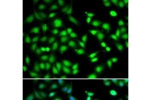 Immunofluorescence analysis of HeLa cells using CDKN2D Polyclonal Antibody (CDKN2D antibody)