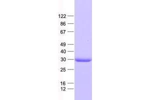 Validation with Western Blot