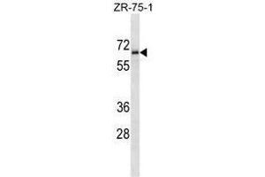 TM117 Antibody (C-term) western blot analysis in ZR-75-1 cell line lysates (35 µg/lane). (TMEM117 antibody  (C-Term))