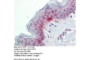 Immunohistochemistry with Human Skin lysate tissue at an antibody concentration of 5. (RAE1 antibody  (C-Term))