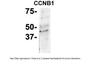 IP Suggested Anti-CCNB1 Antibody Positive Control: NT2 CELL/BRAIN TISSUE (Cyclin B1 antibody  (C-Term))