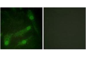 Immunofluorescence analysis of HeLa cells, using Smad2 (Phospho-Thr220) Antibody. (SMAD2 antibody  (pThr220))