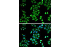 Immunofluorescence analysis of MCF-7 cells using RBPJ antibody (ABIN5973315). (RBPJ antibody)