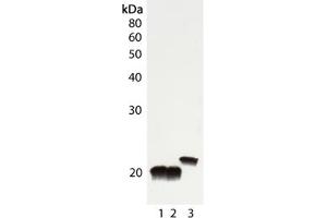 Western blot analysis of Cu/Zn SOD, pAb : Lane 1: Rat liver tissue lysate, Lane 2: Mouse liver tissue lysate, Lane 3: HeLa cell lysate . (SOD1 antibody)