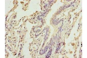 Immunohistochemistry of paraffin-embedded human lung tissue using ABIN7146547 at dilution of 1:100 (Calpain 6 antibody  (AA 195-494))