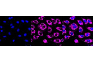 anti-Prostaglandin E Receptor 2 (Subtype EP2), 53kDa (PTGER2) antibody