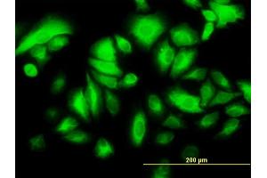 Immunofluorescence of monoclonal antibody to KRT17 on HeLa cell. (KRT17 antibody  (AA 1-432))